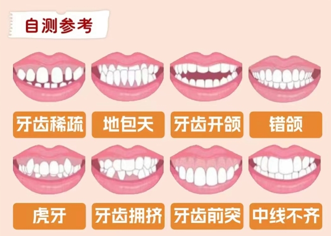 你的牙齿需要矫正吗？不妨进来自查一下